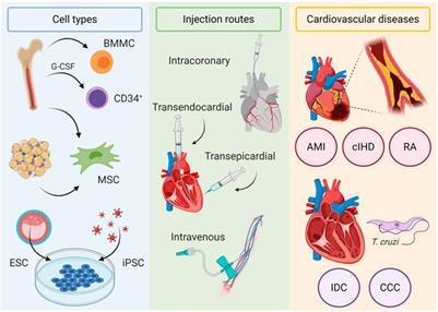 Cell-Based Therapies for Heart Failure